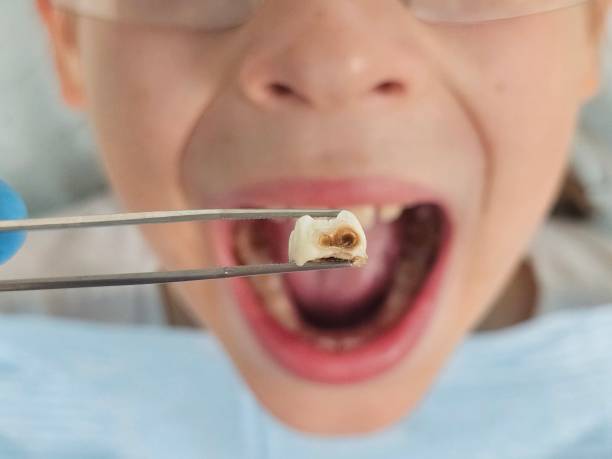 Best Urgent Dental Care  in Alexander, AR